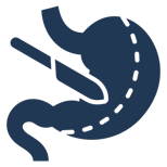 მცირეინვაზიური აბდომინალური ონკოქირურგიისა და ბარიატრიული ქირურგიის დეპარტამენტი