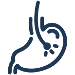 პაციენტის გზამკვლევი - Endoscopy